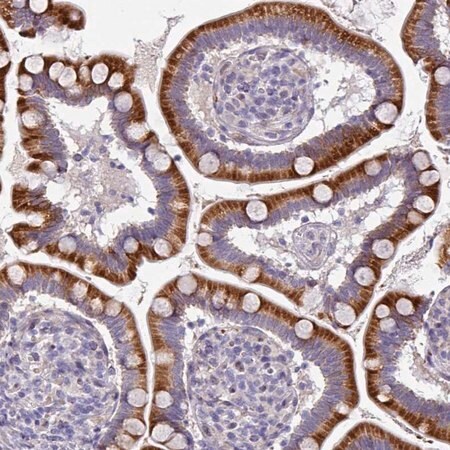 Merck Anti-KLHL3 antibody produced in rabbit