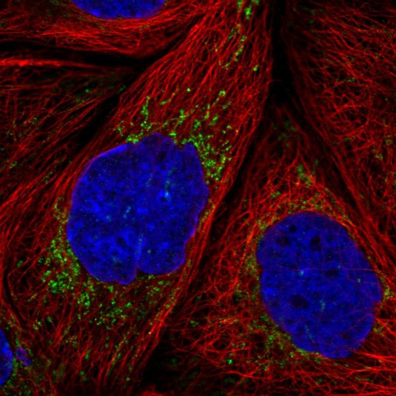 Atlas Antibodies Anti-MRPS36 Antibody