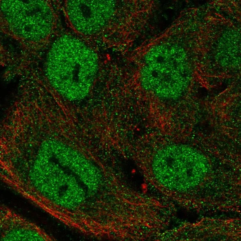 Atlas Antibodies Anti-MTCP1 Antibody