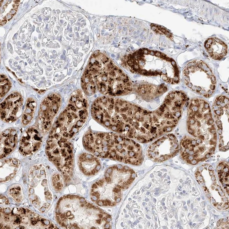 Atlas Antibodies Anti-MTX2 Antibody