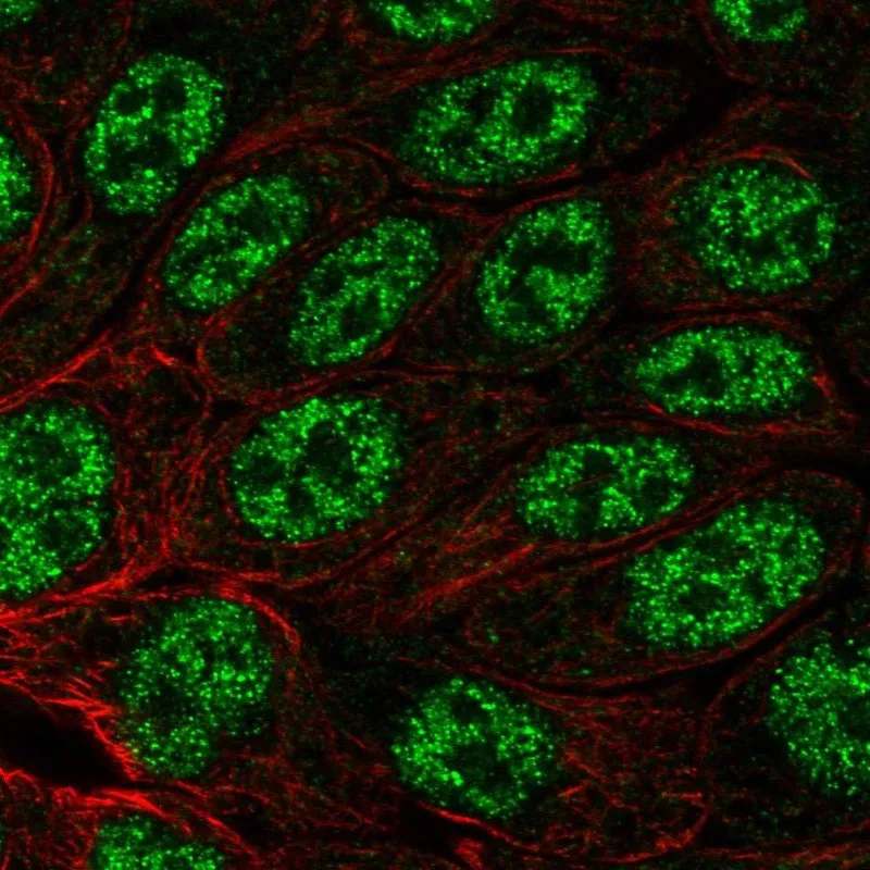 Atlas Antibodies Anti-MYH14 Antibody