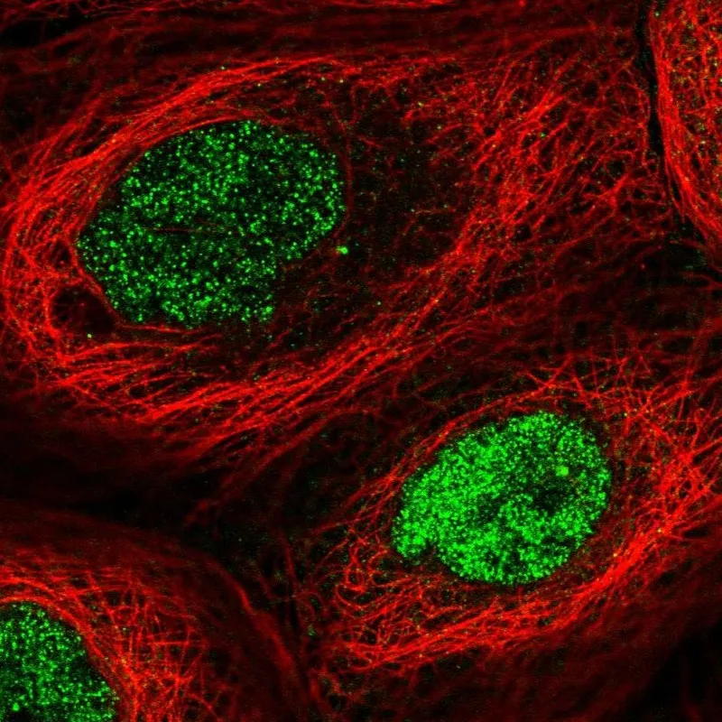Atlas Antibodies Anti-N6AMT1 Antibody