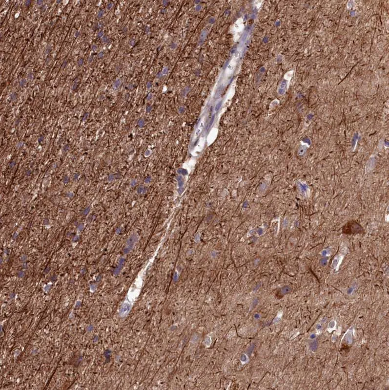 Atlas Antibodies Anti-NAA60 Antibody