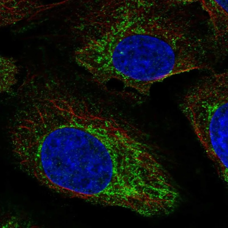 Atlas Antibodies Anti-NAGS Antibody
