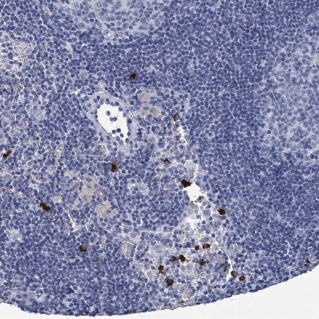 Merck Anti-VPS13D antibody produced in rabbit