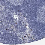 Merck Anti-VPS13D antibody produced in rabbit