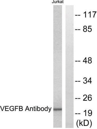 Merck Anti-VEGFB antibody produced in rabbit