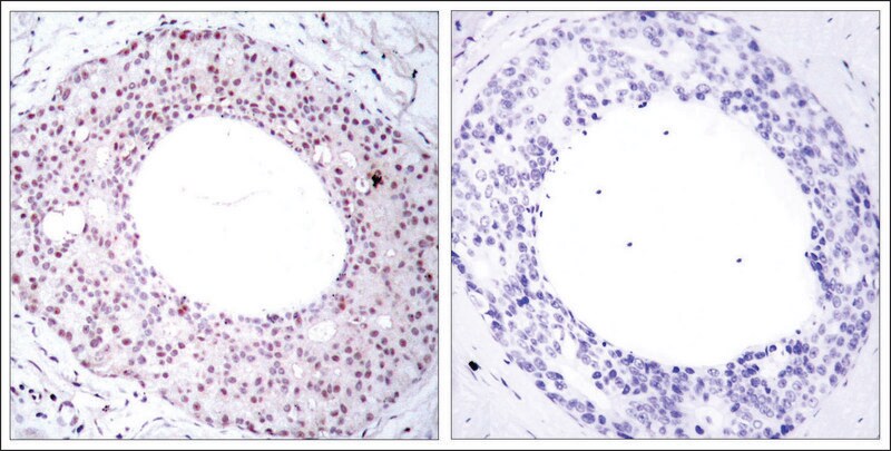 Merck Anti-phospho-RELA (p65/pThr254) antibody produced in rabbit
