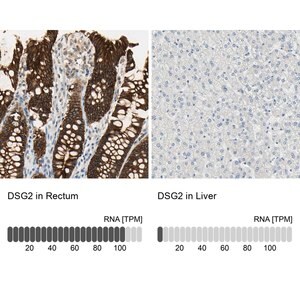 Merck ANTI-DSG2
