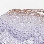 Merck Anti-TMPRSS11E antibody produced in rabbit