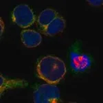 Merck Anti-TACC1 antibody produced in rabbit