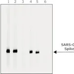 Merck Anti-SARS-CoV-2-Spike protein