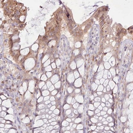 Merck Anti-CCL1 antibody produced in rabbit