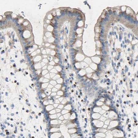 Merck Anti-B4GALT3 antibody produced in rabbit