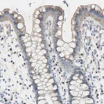 Merck Anti-B4GALT3 antibody produced in rabbit