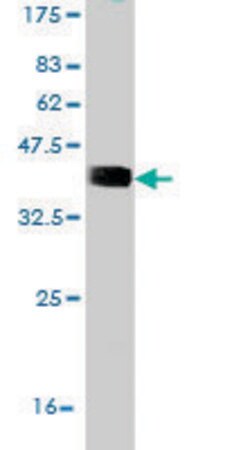 Merck Monoclonal Anti-RNF123 antibody produced in mouse