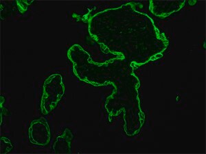 Merck MOUSE MONOCLONAL ANTI-CYTOKERATIN