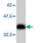 Merck Monoclonal Anti-SLIT3 antibody produced in mouse
