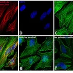 Thermo Fisher Scientific Goat anti-Rabbit IgG (H+L) Highly Cross-Adsorbed Secondary Antibody, Alexa Fluor 546