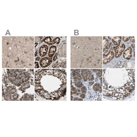 Merck Anti-CYB5R1 antibody produced in rabbit