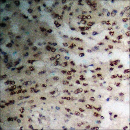 Merck Anti-phospho-TIE2 (pTyr1108) antibody produced in rabbit