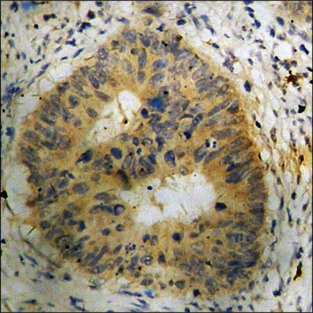 Merck Anti-phospho-ASK1 (pSer83) antibody produced in rabbit