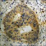 Merck Anti-phospho-ASK1 (pSer83) antibody produced in rabbit
