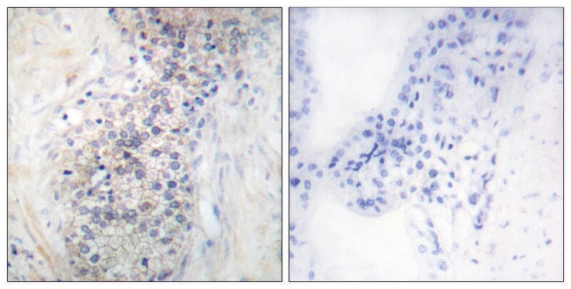 Merck Anti-LRAT antibody produced in rabbit