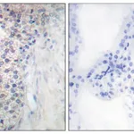 Merck Anti-LRAT antibody produced in rabbit