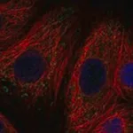 Merck Anti-SLC11A1 antibody produced in rabbit