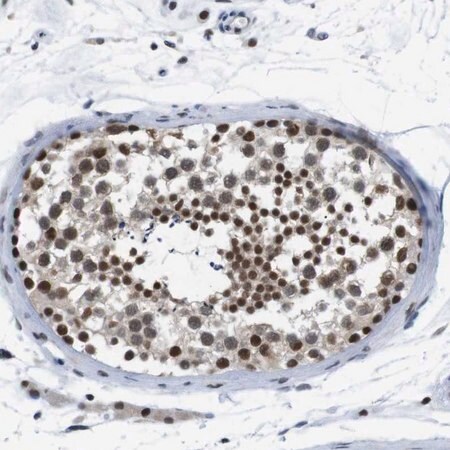 Merck Anti-PSME3 antibody produced in rabbit