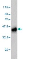 Merck MONOCLONAL ANTI-PLAG1