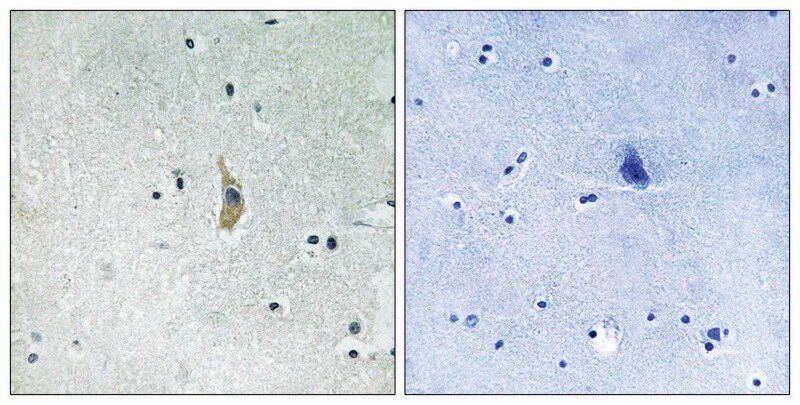 Merck Anti-PSEN1 antibody produced in rabbit