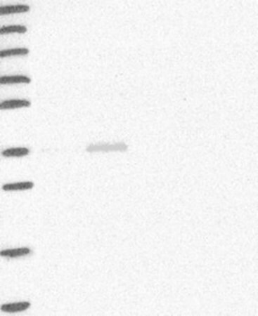 Merck Anti-HAO2 antibody produced in rabbit