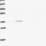 Merck Anti-HAO2 antibody produced in rabbit