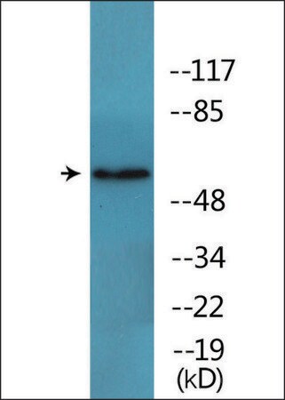 Merck Anti-phospho-FRS2 (pTyr436) antibody produced in rabbit
