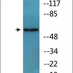 Merck Anti-phospho-FRS2 (pTyr436) antibody produced in rabbit