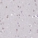 Merck Anti-CEP72 antibody produced in rabbit