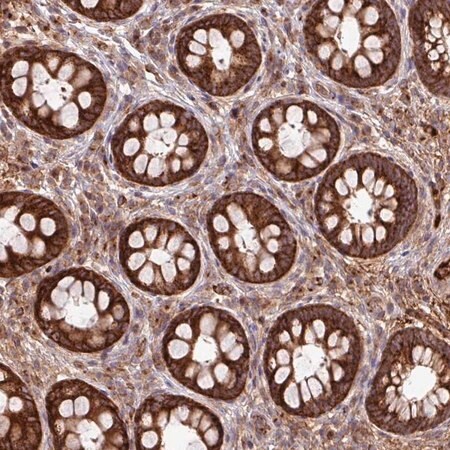 Merck Anti-LSM12 antibody produced in rabbit