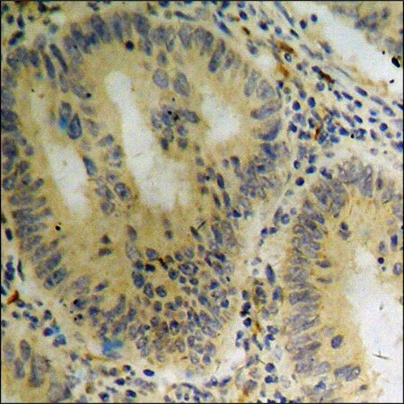 Merck Anti-phospho-ASK1 (pSer966) antibody produced in rabbit