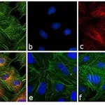 Thermo Fisher Scientific Goat anti-Rat IgG (H+L) Secondary Antibody, Rhodamine