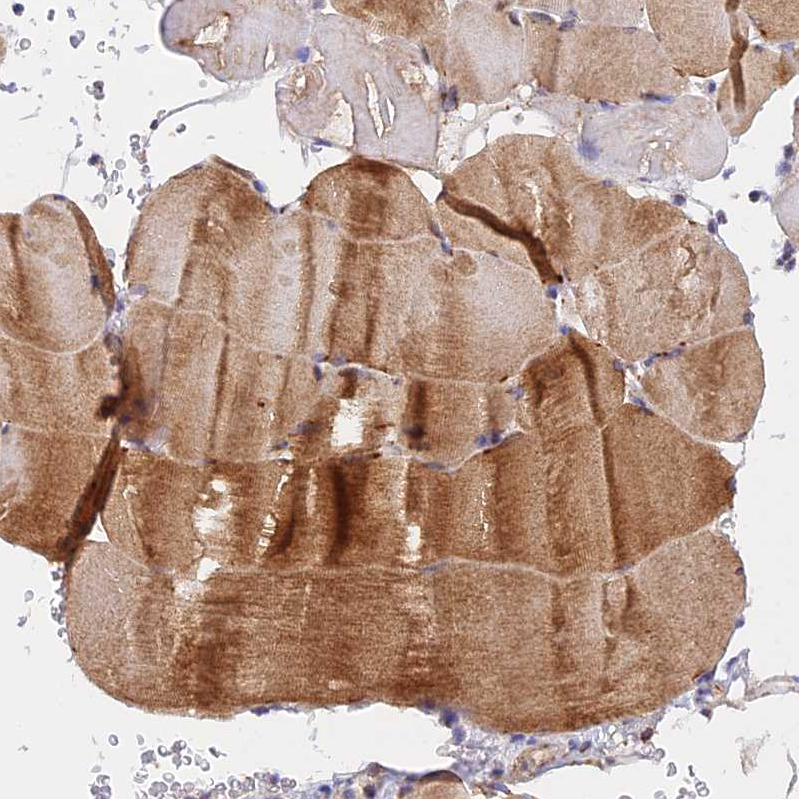 Atlas Antibodies Anti-NDUFB6 Antibody