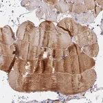 Atlas Antibodies Anti-NDUFB6 Antibody