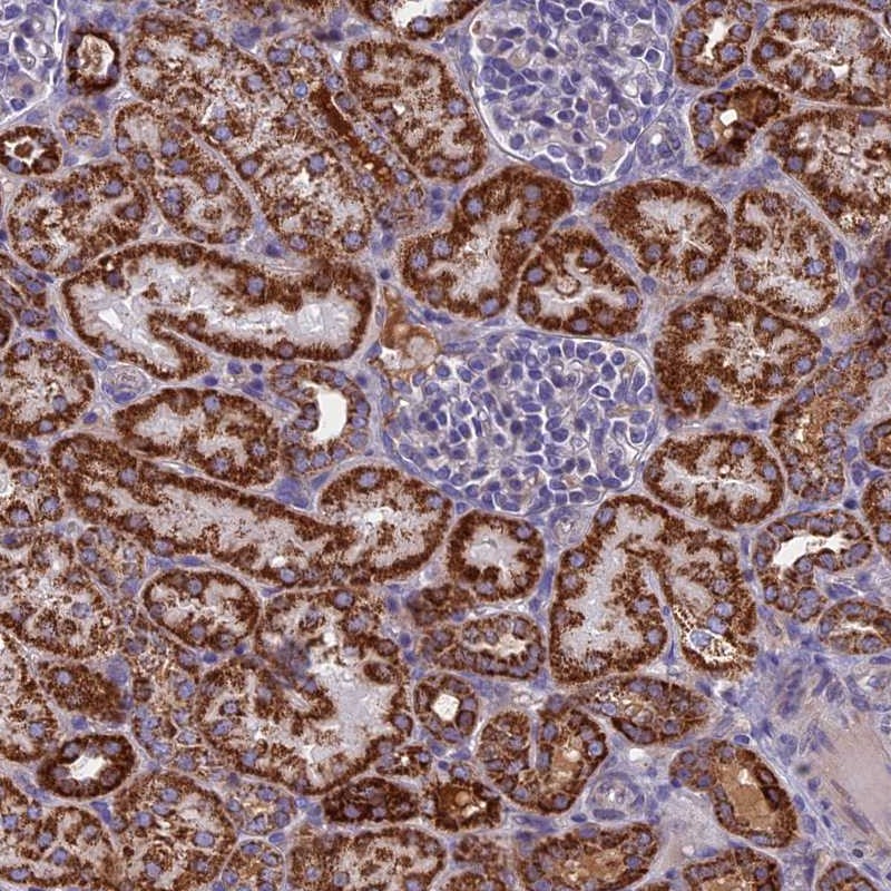 Atlas Antibodies Anti-NDUFB9 Antibody