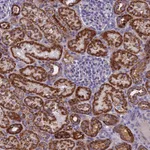 Atlas Antibodies Anti-NDUFB9 Antibody