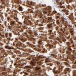 Atlas Antibodies Anti-NDUFB7 Antibody