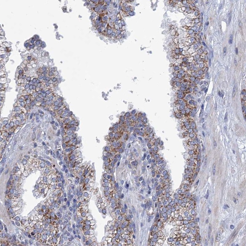 Atlas Antibodies Anti-NDUFC2 Antibody