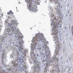 Atlas Antibodies Anti-NDUFC2 Antibody