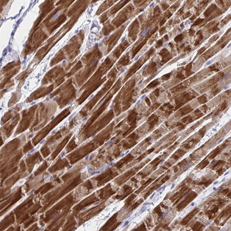 Atlas Antibodies Anti-NDUFC2 Antibody