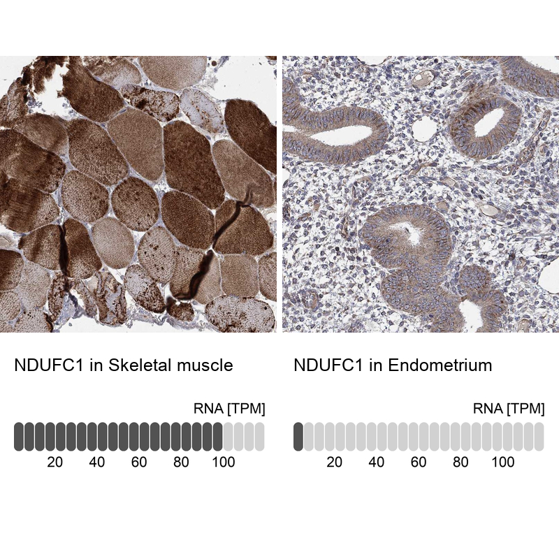 Atlas Antibodies Anti-NDUFC1 Antibody